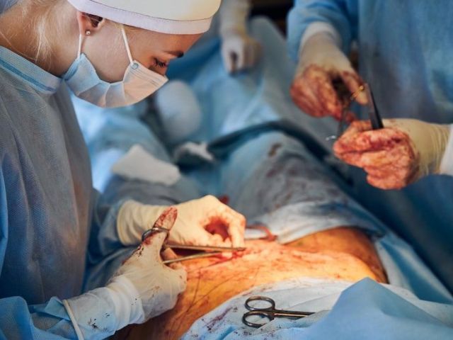 trusted-laparoscopy-surgery-in-gandhinagar