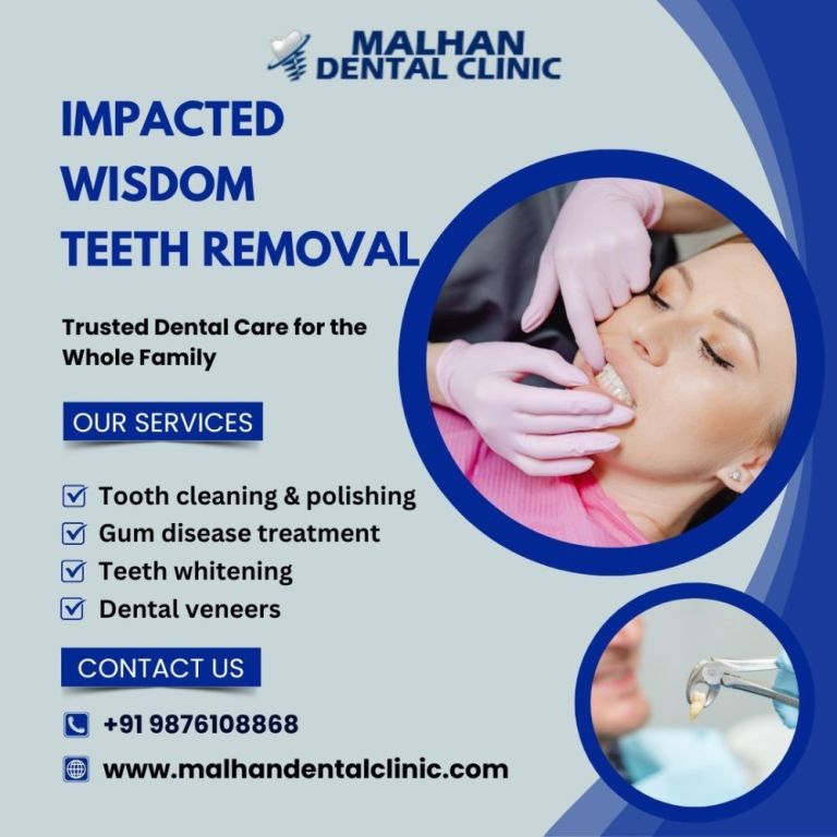 impacted-wisdom-teeth-removal-at-malhan-dental-clinic-big-0