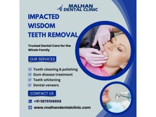 impacted-wisdom-teeth-removal-at-malhan-dental-clinic-small-0