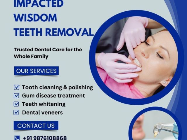 impacted-wisdom-teeth-removal-at-malhan-dental-clinic