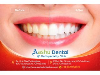 restore-your-smile-with-full-mouth-rehabilitation-treatment-small-0