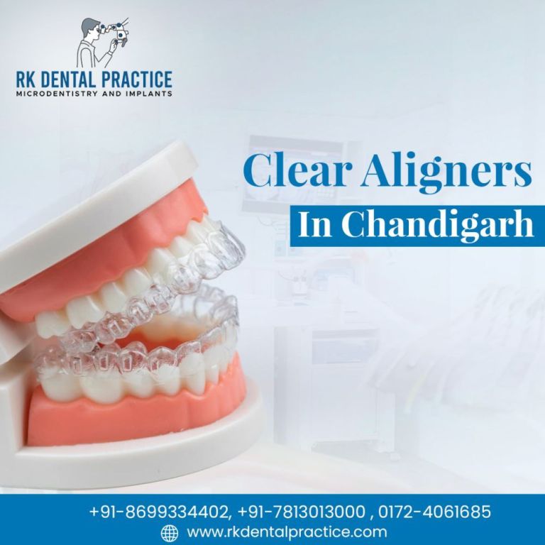 clear-aligners-in-chandigarh-for-invisible-teeth-straightening-big-0