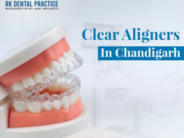 clear-aligners-in-chandigarh-for-invisible-teeth-straightening