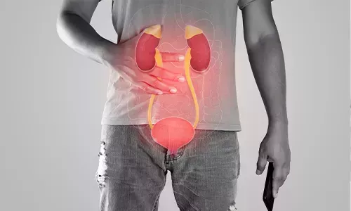 bladder-cancer-treatment-in-delhi-big-0