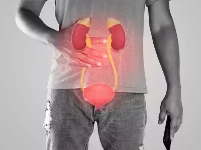 bladder-cancer-treatment-in-delhi