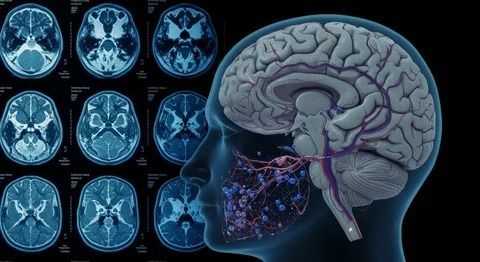 functional-mri-brain-mapping-in-mumbai-picture-this-big-0