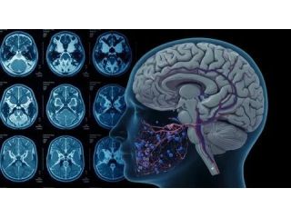 functional-mri-brain-mapping-in-mumbai-picture-this-small-0