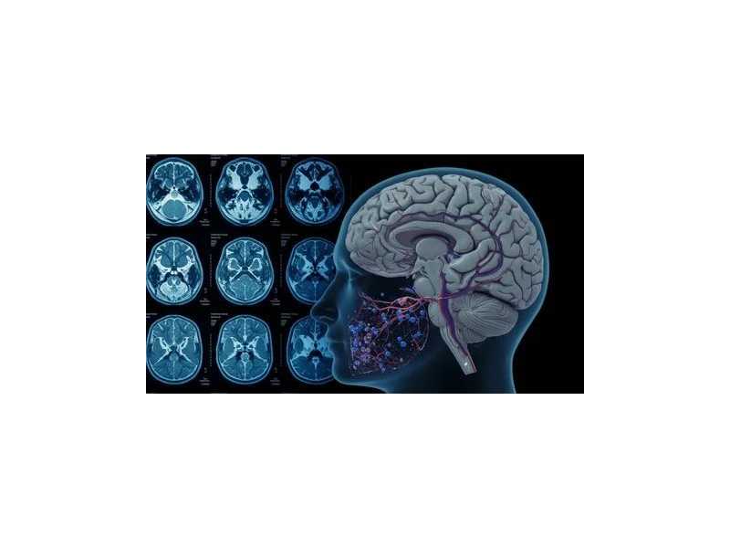 functional-mri-brain-mapping-in-mumbai-picture-this-small-0