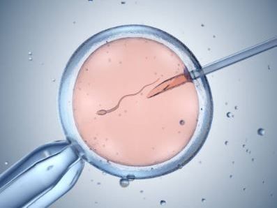 advanced-iui-treatment-in-kolkata-at-uma-medical