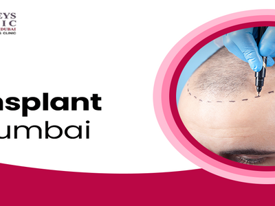 get-natural-hair-at-best-hair-transplant-clinic-in-mumbai