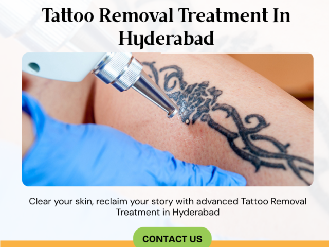 tattoo-removal-treatment-in-hyderabad-dr-venus