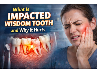 what-is-impacted-wisdom-tooth-and-why-it-hurts-small-0