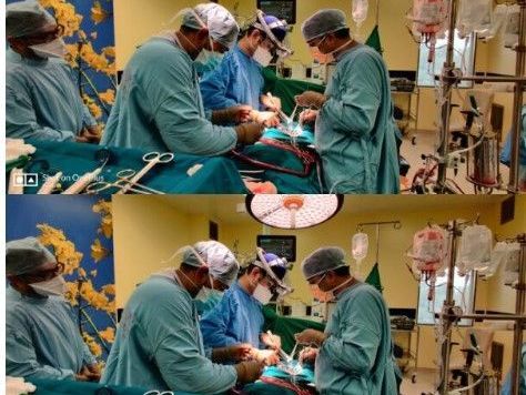 best-bypass-surgeon-in-pune-1500-successful-surgeries
