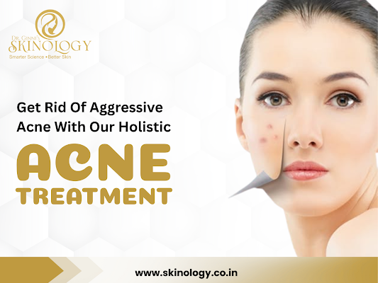 laser-acne-scar-treatment-in-indore-for-smooth-skin