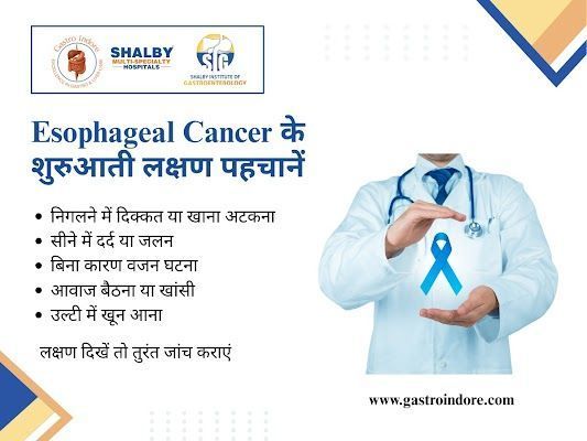 cancer-hospital-for-esophageal-cancer-in-indore-near-you