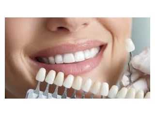 aesthetic-dentistry-clinic-in-chetla-for-perfect-smile-small-0