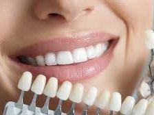 aesthetic-dentistry-clinic-in-chetla-for-perfect-smile