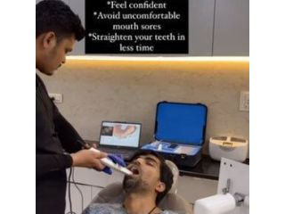 comprehensive-guide-to-best-dental-implant-in-jaipur-small-0