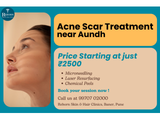 acne-scar-treatment-near-aundh-for-pune-commuters-small-0