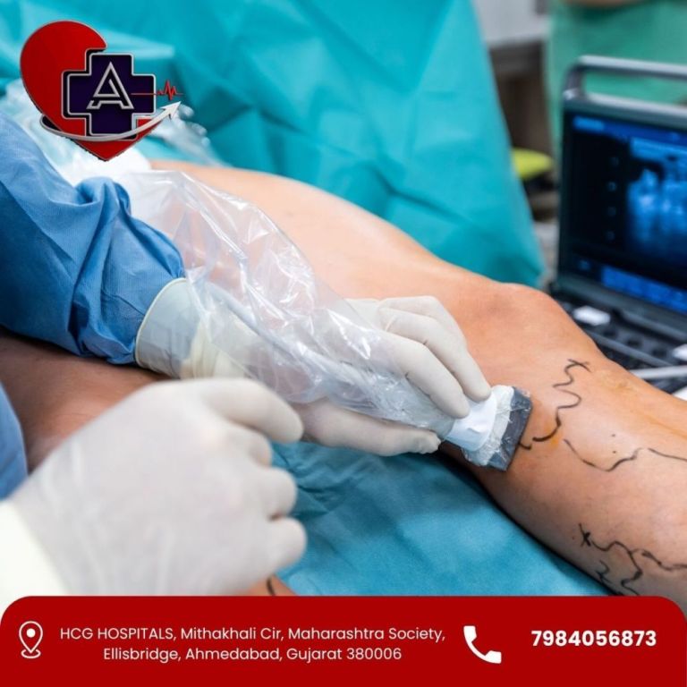 safe-modern-vascular-surgery-in-ahmedabad-for-long-term-relief-big-0
