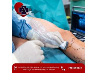 safe-modern-vascular-surgery-in-ahmedabad-for-long-term-relief-small-0