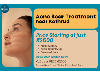 get-clearer-skin-with-acne-scar-treatment-near-kothrud-small-0