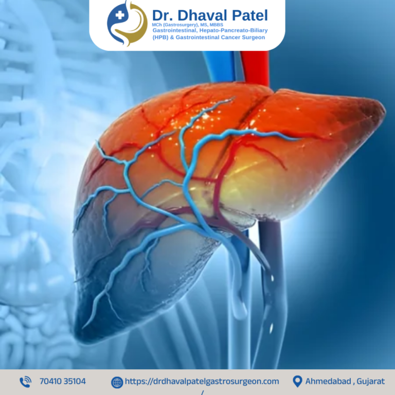 best-liver-bile-duct-cancer-surgery-by-dr-dhaval-patel-big-0