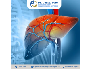 best-liver-bile-duct-cancer-surgery-by-dr-dhaval-patel-small-0