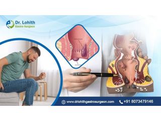 get-the-best-piles-treatment-in-bangalore-today-small-0