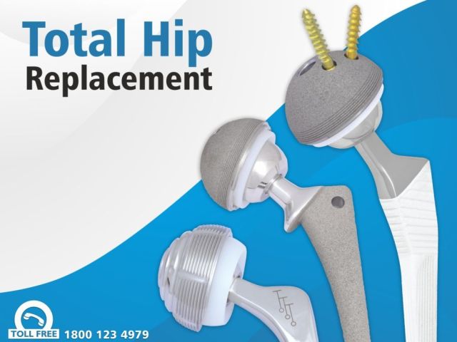 high-quality-hip-replacement-prosthesis-implants-manufacturer