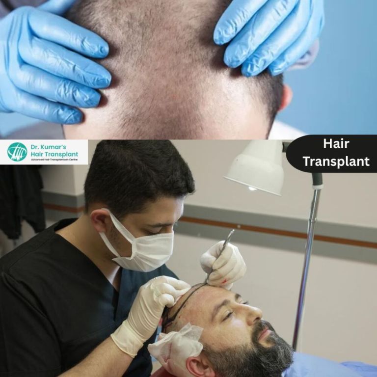 advanced-hair-restoration-solutions-in-kondapur-with-expert-care-big-0