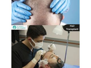 advanced-hair-restoration-solutions-in-kondapur-with-expert-care-small-0