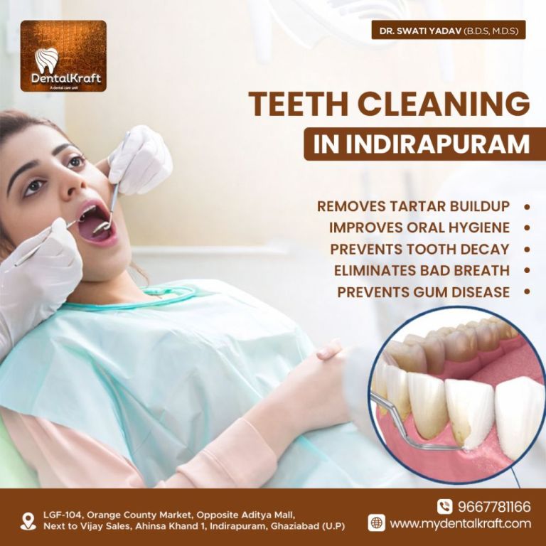 teeth-cleaning-in-indirapuram-for-a-healthy-smile-big-0