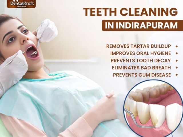 teeth-cleaning-in-indirapuram-for-a-healthy-smile