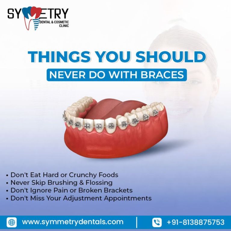 best-braces-specialist-near-me-for-expert-orthodontic-care-big-0