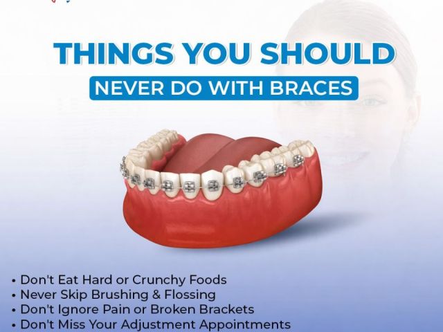 best-braces-specialist-near-me-for-expert-orthodontic-care
