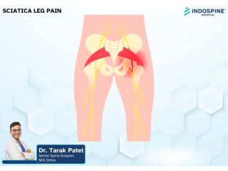 effective-sciatica-leg-pain-treatment-relief-from-nerve-pain-small-0