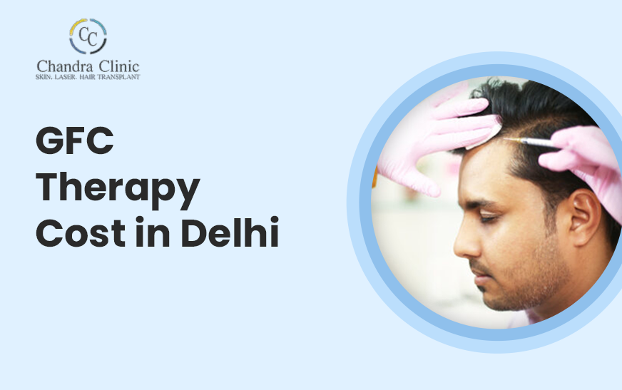 gfc-therapy-cost-in-delhi-big-0
