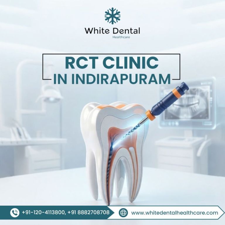looking-for-a-reliable-rct-clinic-in-indirapuram-big-0