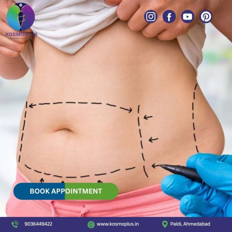 get-back-your-stomach-shape-with-tummy-tuck-surgery-in-ahmedabad-big-0