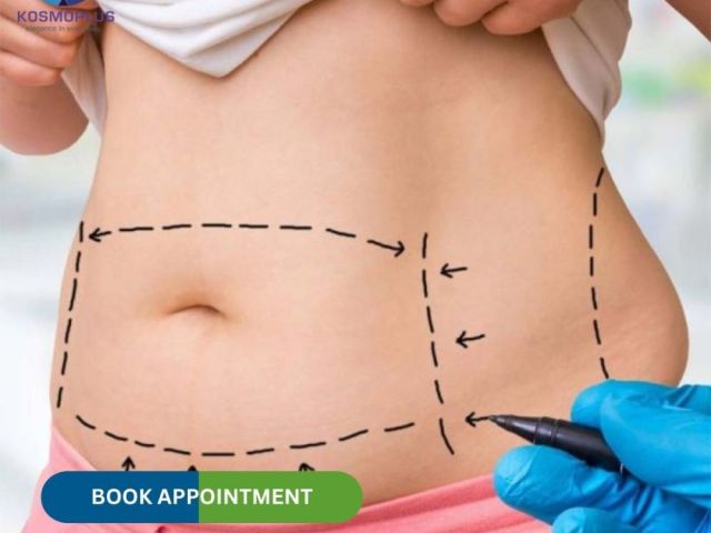 get-back-your-stomach-shape-with-tummy-tuck-surgery-in-ahmedabad