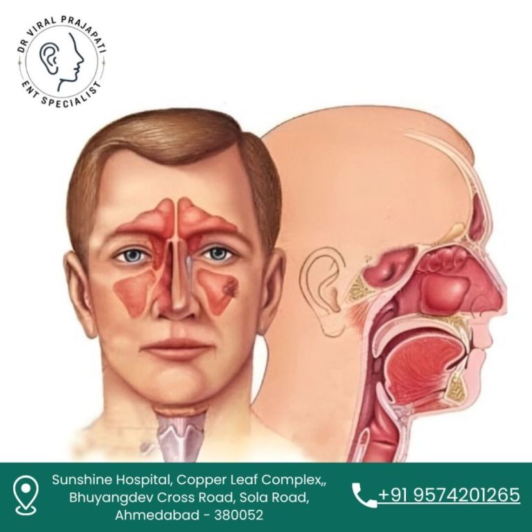 best-ent-surgeon-in-ahmedabad-for-voice-problems-big-0
