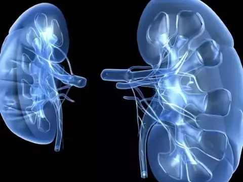 perm-catheter-for-dialysis-procedure-benefits-care-guide