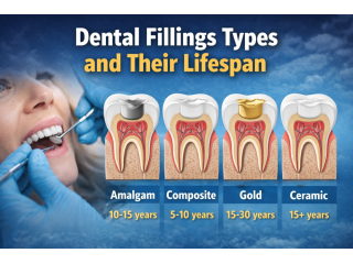 dental-fillings-types-and-their-lifespan-small-0