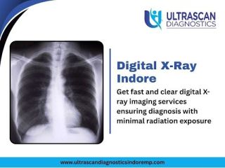 diagnostic-centre-in-indore-x-ray-ultrasound-small-0