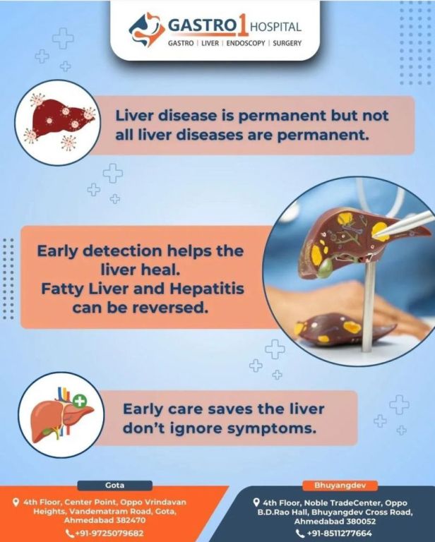 safe-and-effective-liver-treatment-in-ahmedabad-big-0