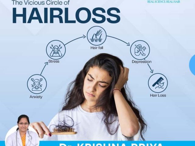 best-hair-transplant-doctors-in-rajahmundry