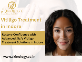 advanced-vitiligo-treatment-solutions-in-indore-city-small-0