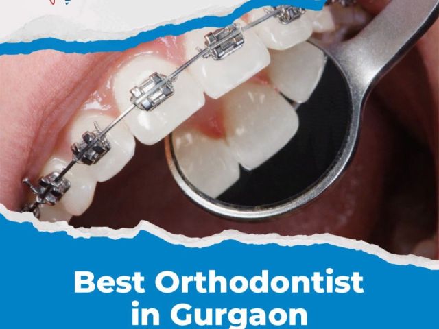 best-orthodontist-in-gurgaon-for-perfect-teeth-alignment