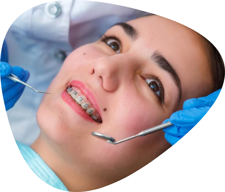 braces-treatment-tooth-extraction-for-better-smile-big-0